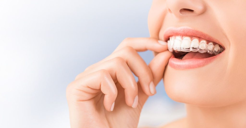 установить капы