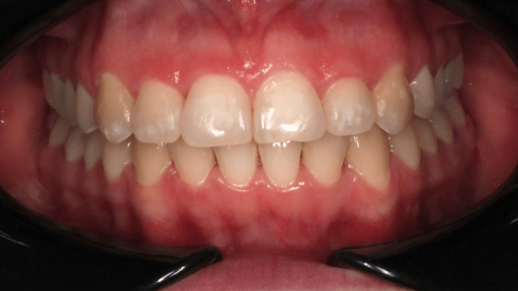 Портфолио - после 1