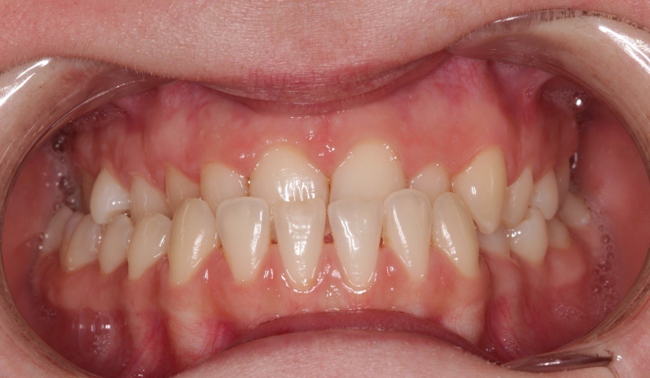 Портфолио - основное изображение