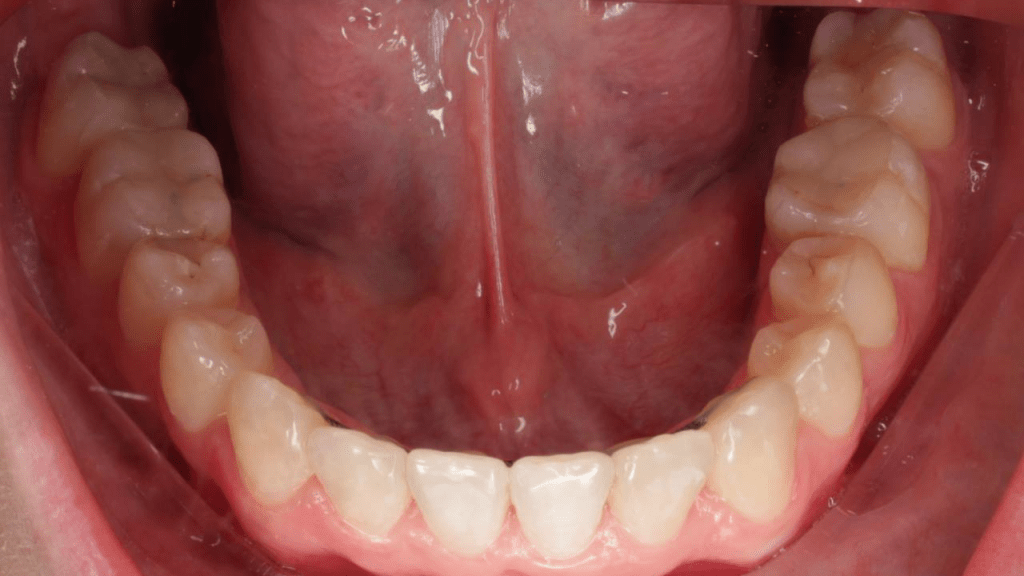 Портфолио - после 3