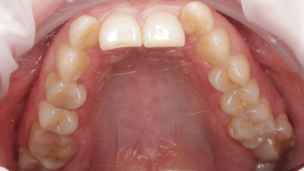 Портфолио - основное изображение