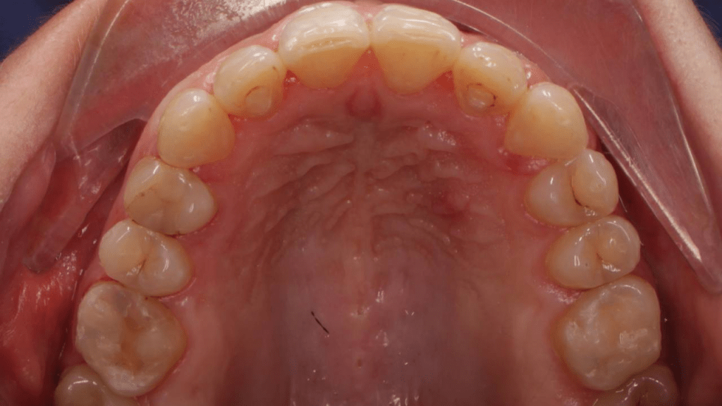 Портфолио - после 1