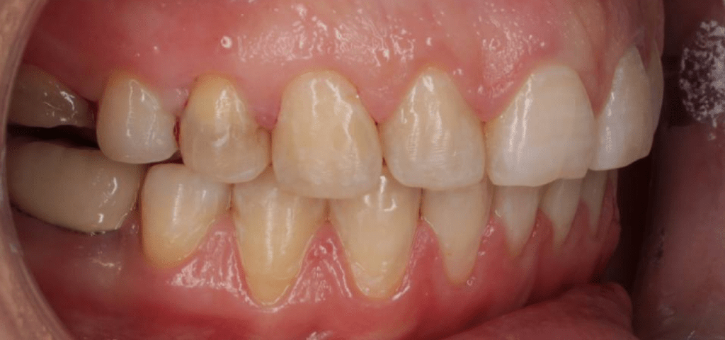 Портфолио - после 2