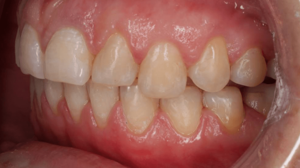 Портфолио - после 3