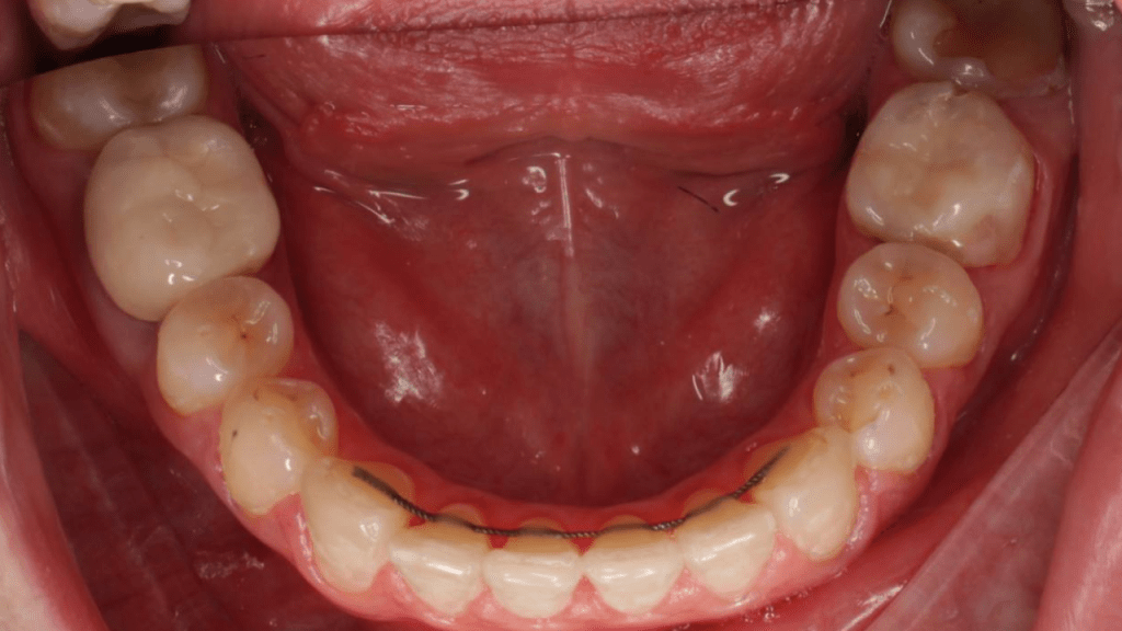 Портфолио - после 4