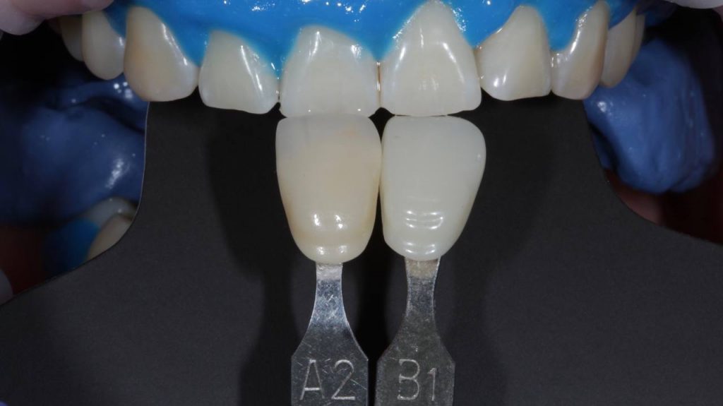 Портфолио - до 2