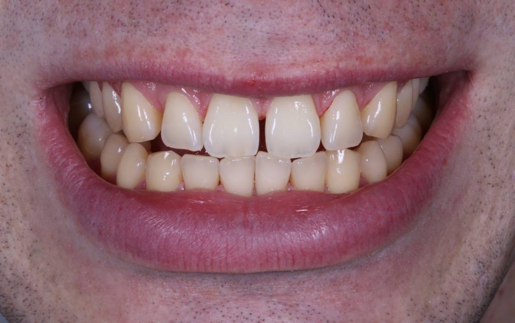 Портфолио - после 3