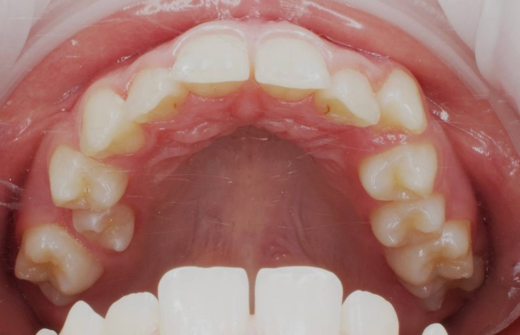 Портфолио - до 4