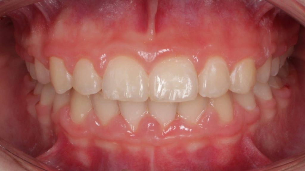 Портфолио - после 1