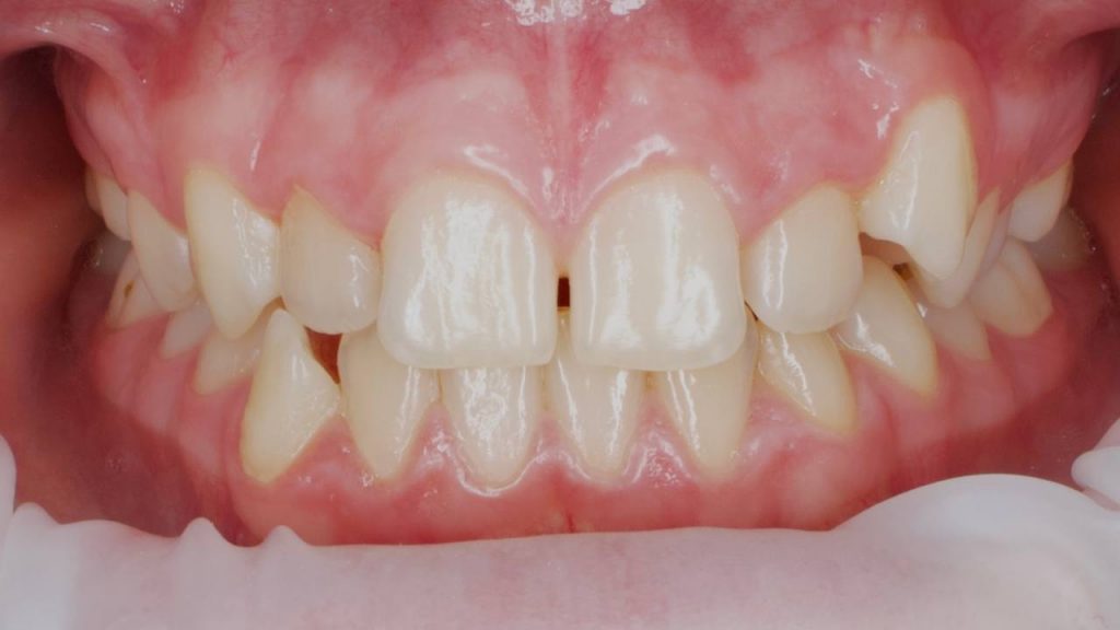 Портфолио - основное изображение