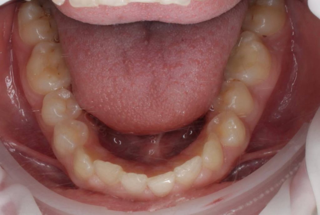 Портфолио - до 4