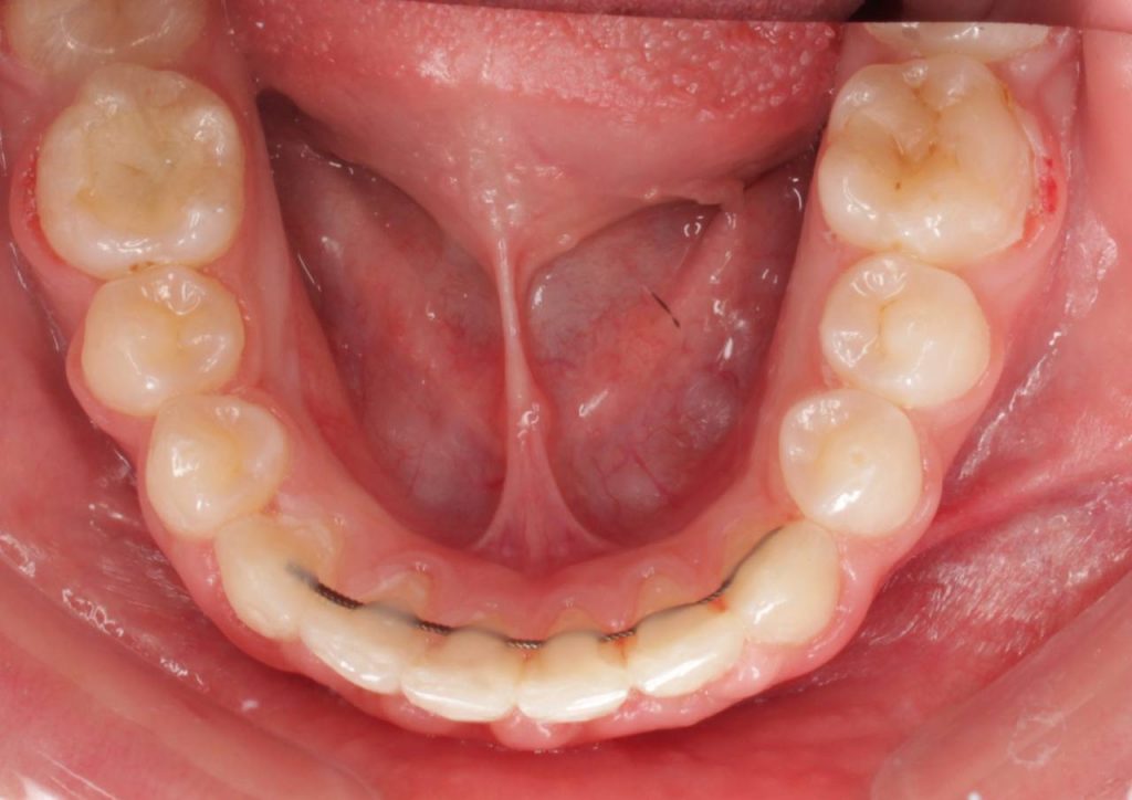 Портфолио - после 4