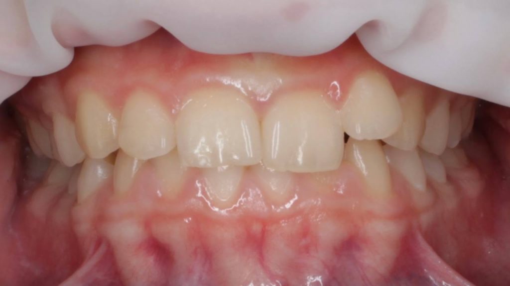 Портфолио - основное изображение