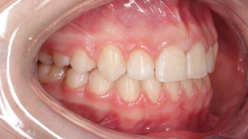 Портфолио - после 3