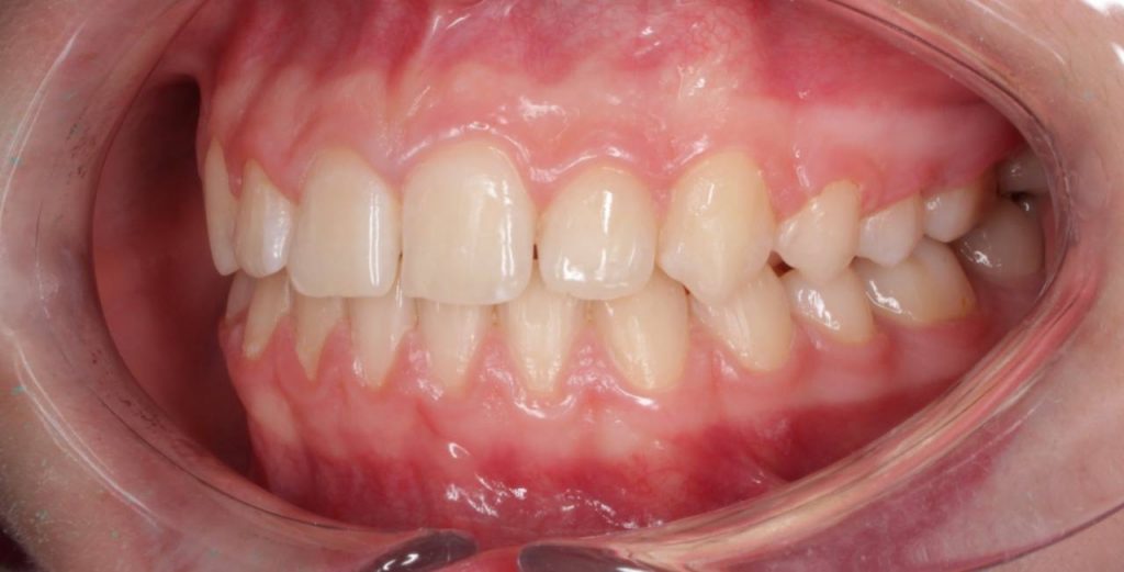 Портфолио - после 2