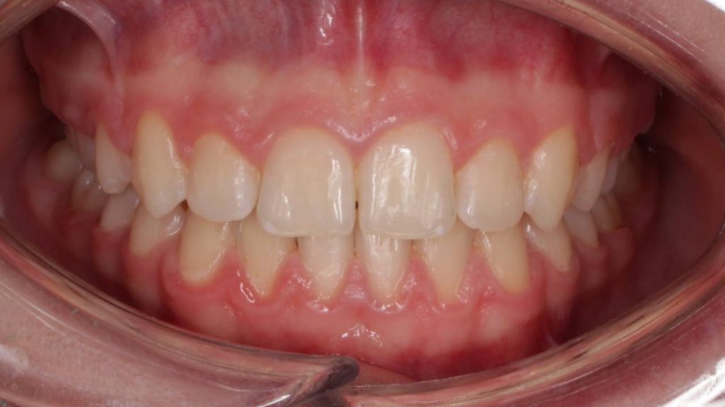 Портфолио - после 1