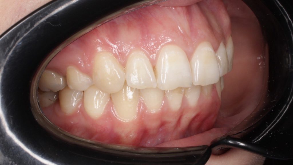 Портфолио - после 3