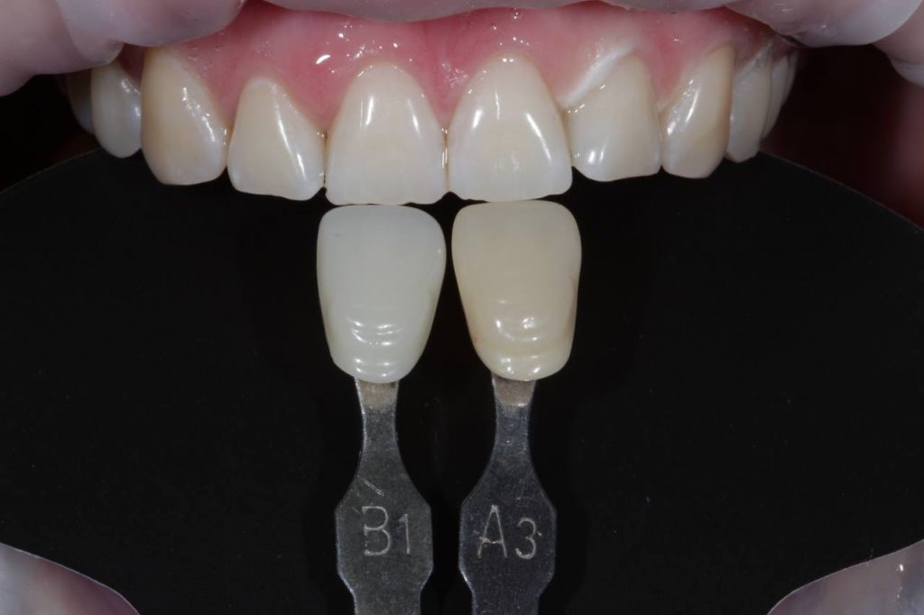 Портфолио - после 1