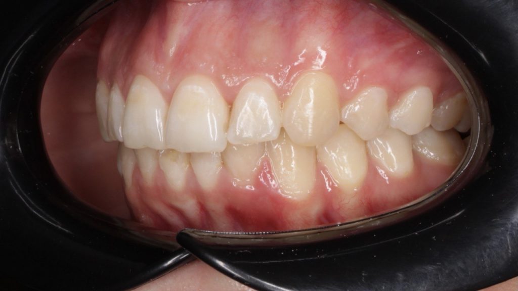 Портфолио - после 2