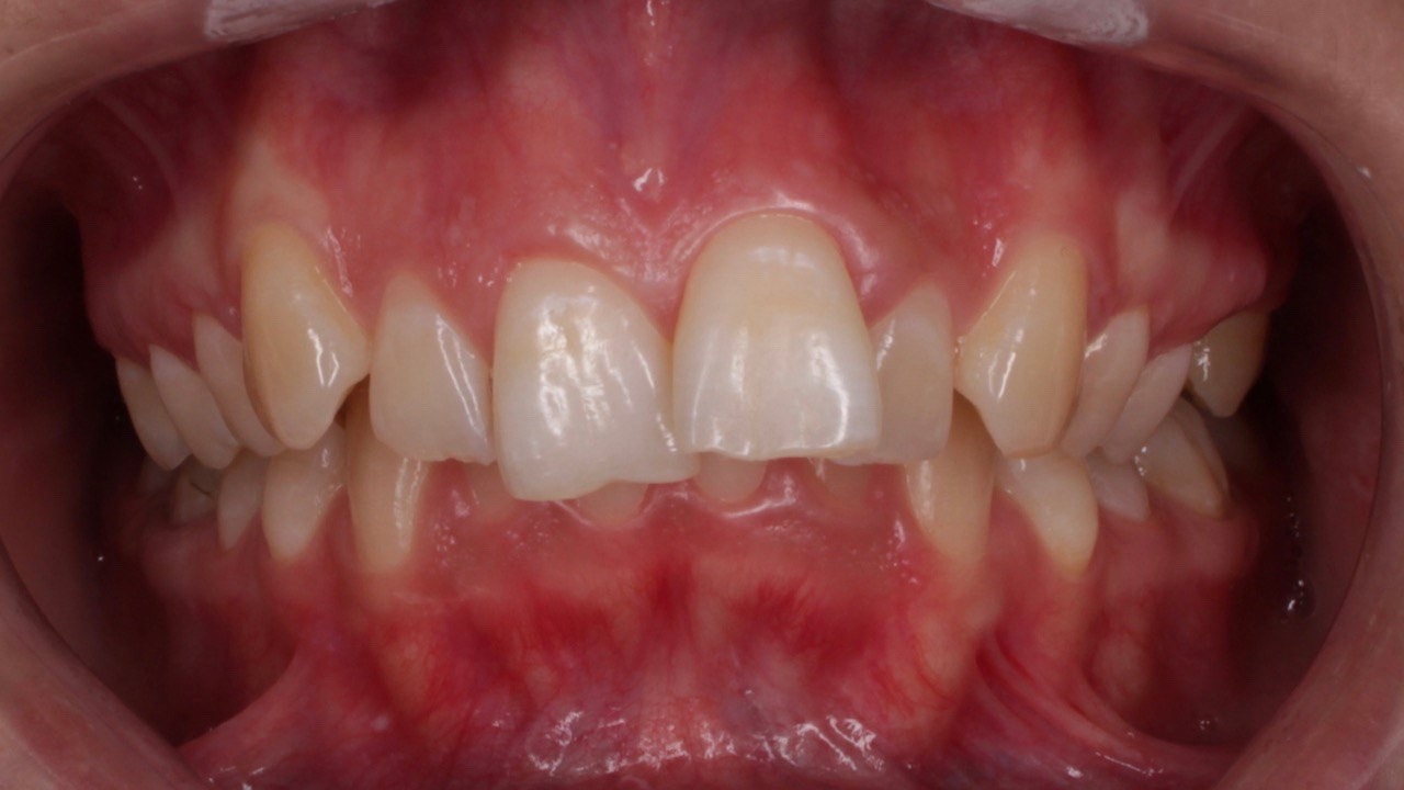 Портфолио - основное изображение