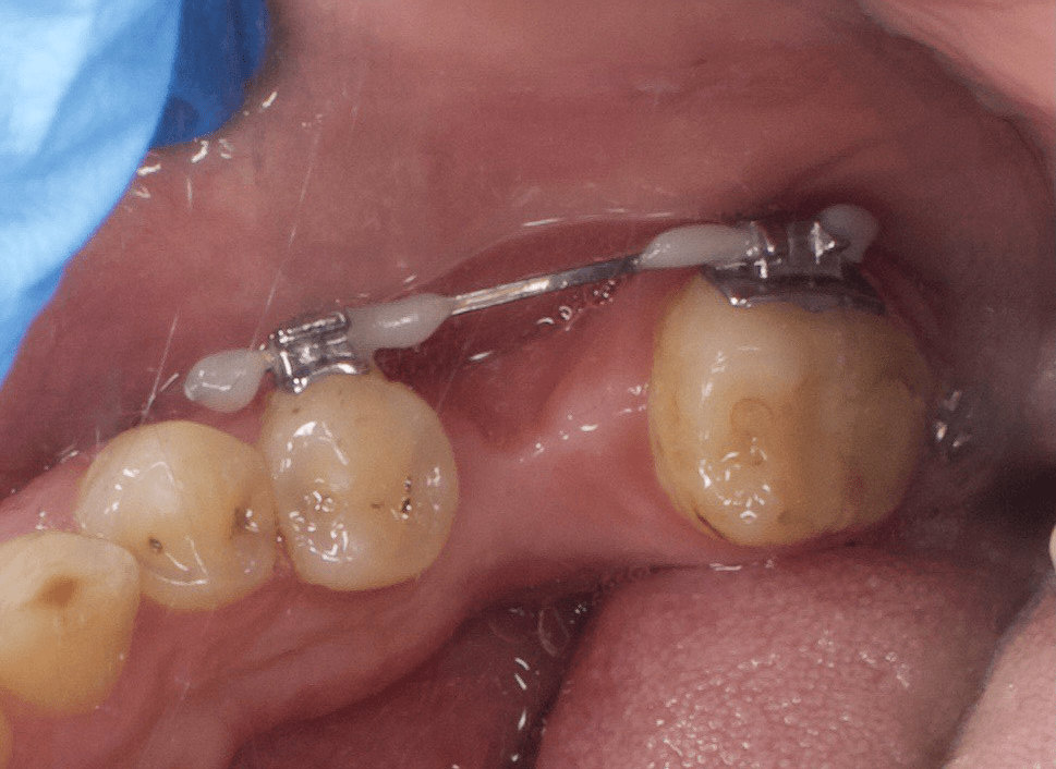 Портфолио - основное изображение