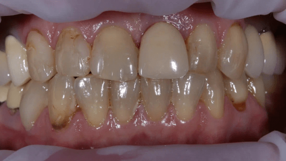 Портфолио - основное изображение