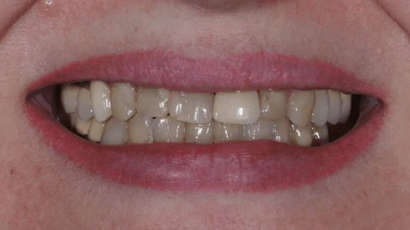 Портфолио - до 2