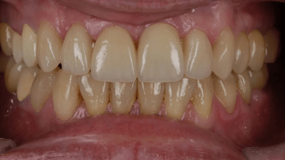 Портфолио - после 1