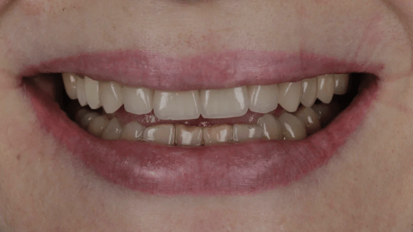 Портфолио - после 2