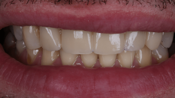 Портфолио - после 1