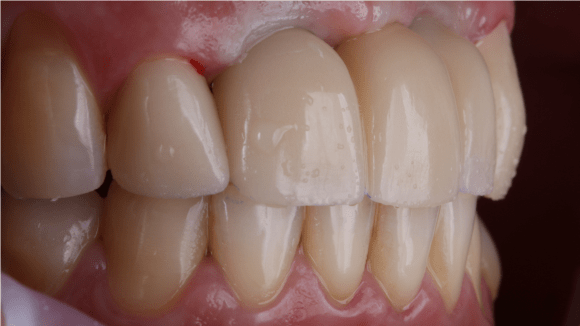 Портфолио - после 3