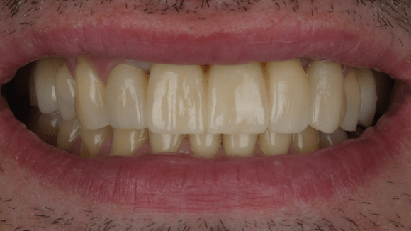 Портфолио - основное изображение