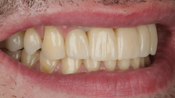 Портфолио - до 2