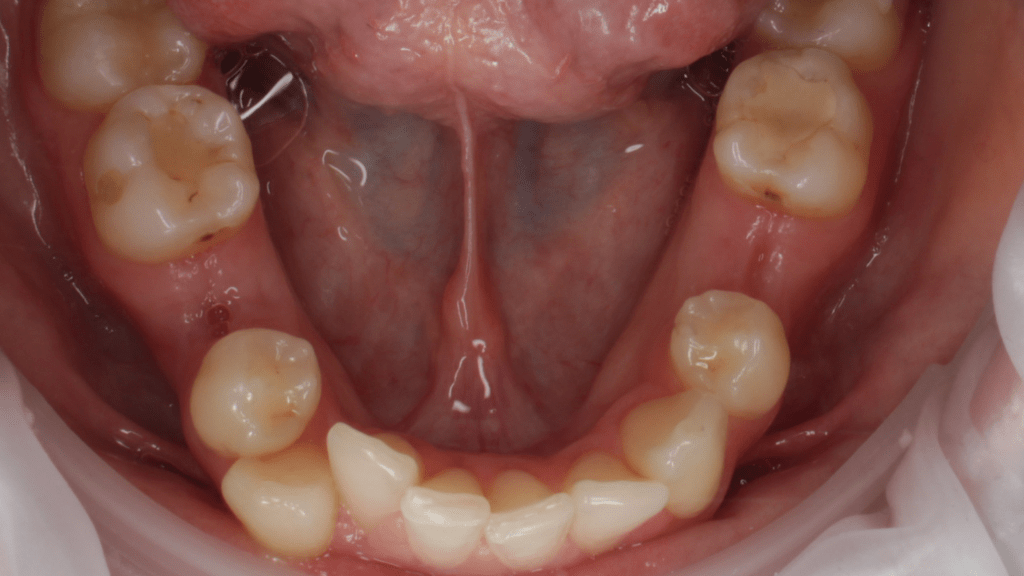 Портфолио - основное изображение