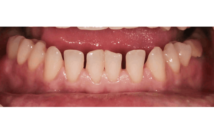 Портфолио - до 2