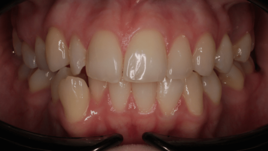 Портфолио - до 2