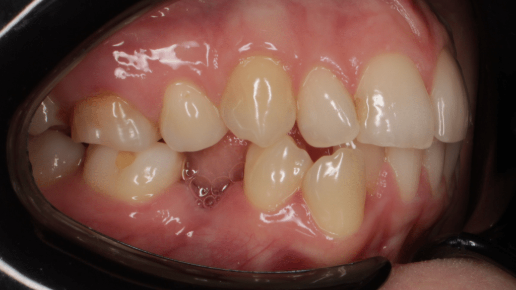 Портфолио - до 3