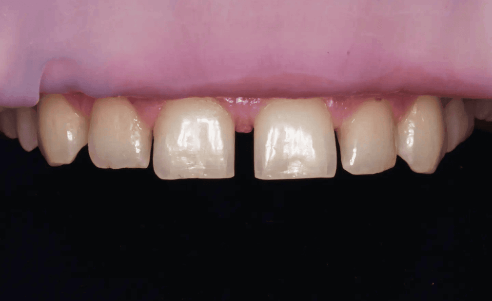 Портфолио - до 2