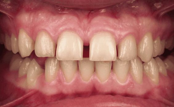 Портфолио - основное изображение