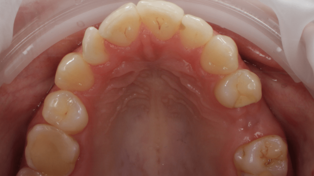 Портфолио - до 5