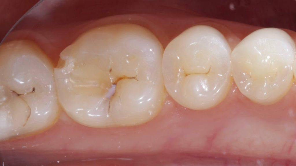 Портфолио - основное изображение