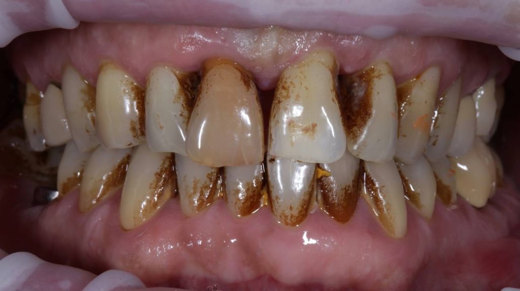 Портфолио - основное изображение