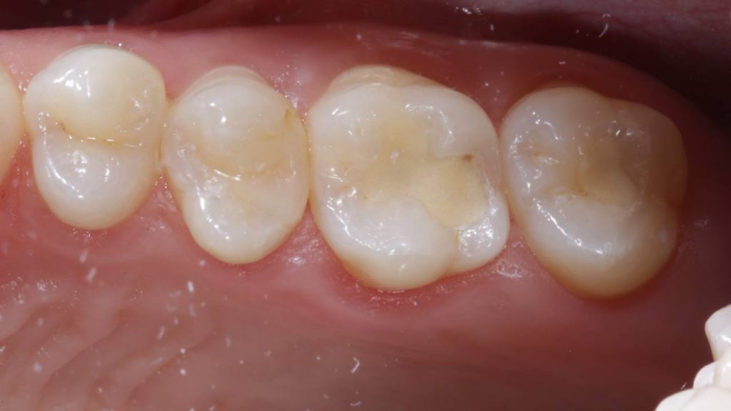 Портфолио - основное изображение