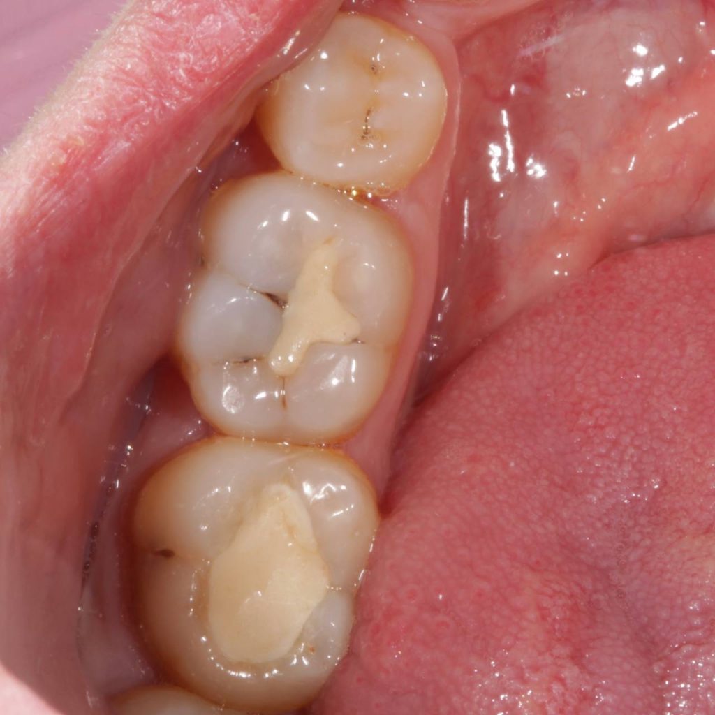 Портфолио - основное изображение