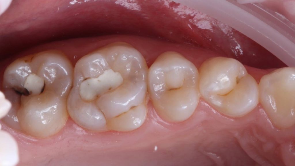 Портфолио - основное изображение