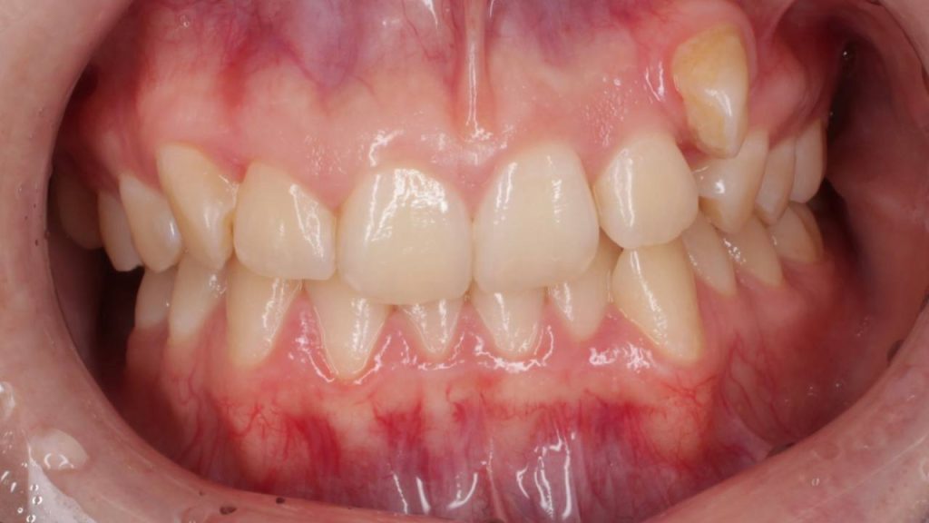 Портфолио - основное изображение