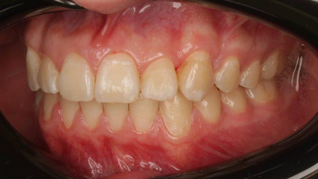 Портфолио - после 2