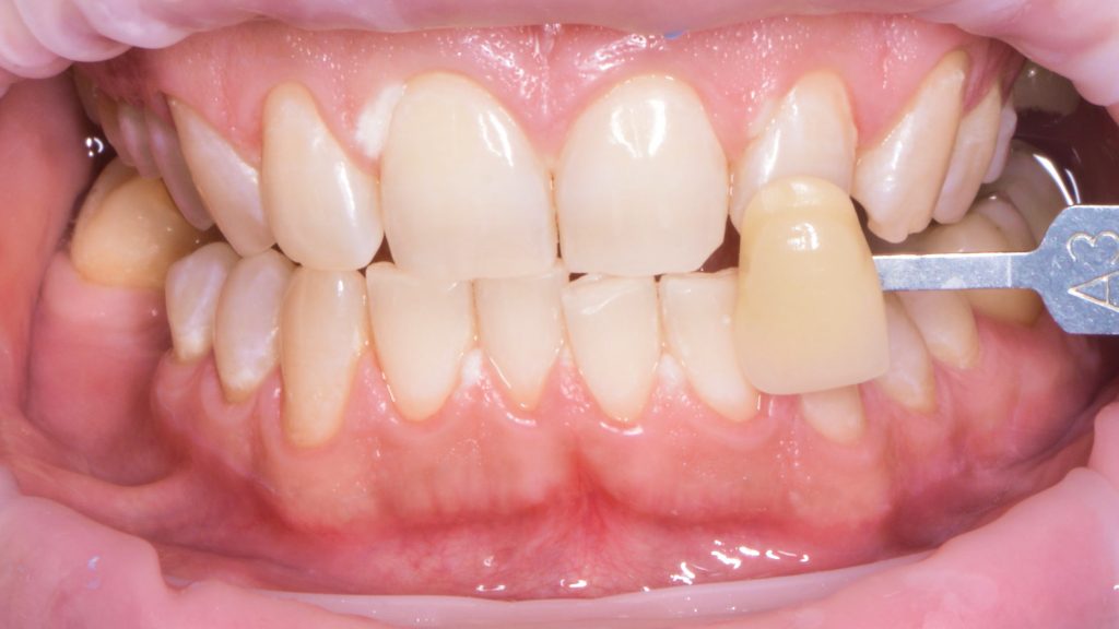 Портфолио - после 1