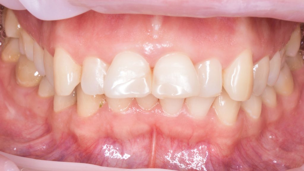 Портфолио - основное изображение