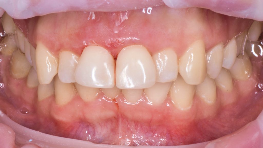 Портфолио - после 1